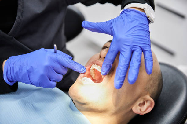 Best Emergency Dentist for Knocked-Out Tooth in Apalachin, NY